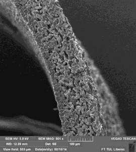 VACULAR GRAFT Vascular graft made