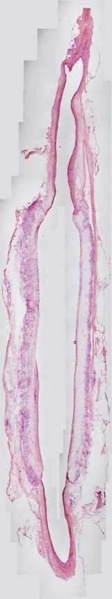 abdominal aorta, 6 months implantation PCL nanofibrous vascular