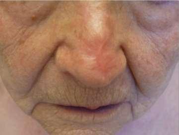 patiens promising results clinical study in