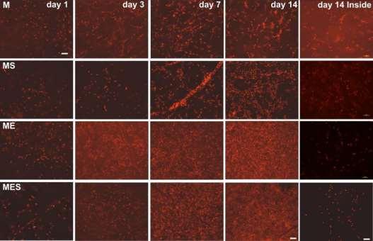 absorbance at 570 nm Department of Nonwovens and Nanofibrous Materials BONE REGENERATION MELTBLOWN+ELSPIN Were