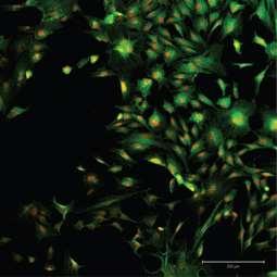 (classical) and patterned nanofibrous electrospun layer