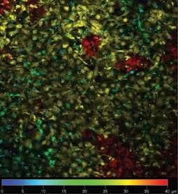 layer CARTILAGE REGENERATION 3D PRINT+ELSPIN a) b) c) d)