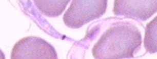 rhodesiense - trypanozóma rhodézská,