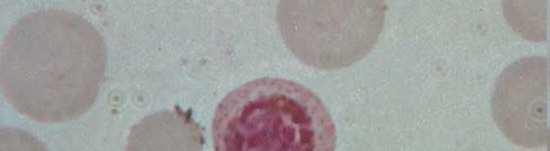 charakteristika a zástupci Chromalveolata Apicomlexa Hematozoea Hematozoea krvinkovky Malárie (ze staroitalského mala aria =