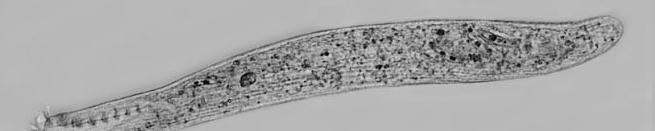 charakteristikaa zástupci Chromalveolata Ciliophora Heterotrichea Heterotrichea dlouhé tělo, často stažitelné makronucleus dělen makronukleárními mikrotubuly Heterotrichida - různobrví krátké cilie