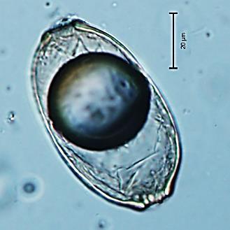 Druh: Capillaria sp.