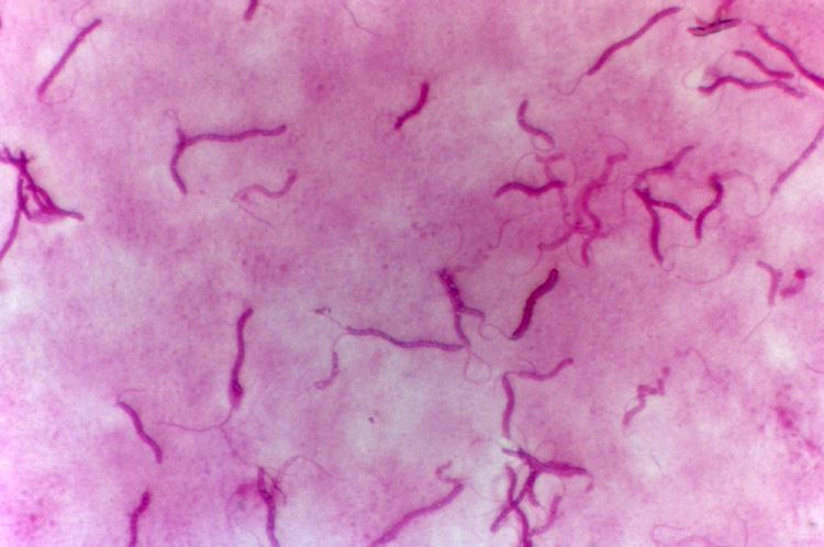 peptidoglykan (Nacetylglukosamin a kyselina N- acetylmuramová stěna tenčí stavba složitější (+ zevní membrána vně