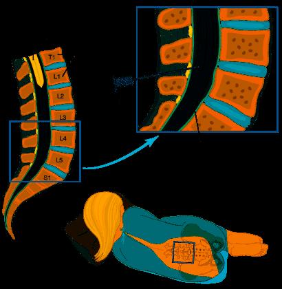 Subarachnoidální blokáda Anatomie páteřního kanálu mícha