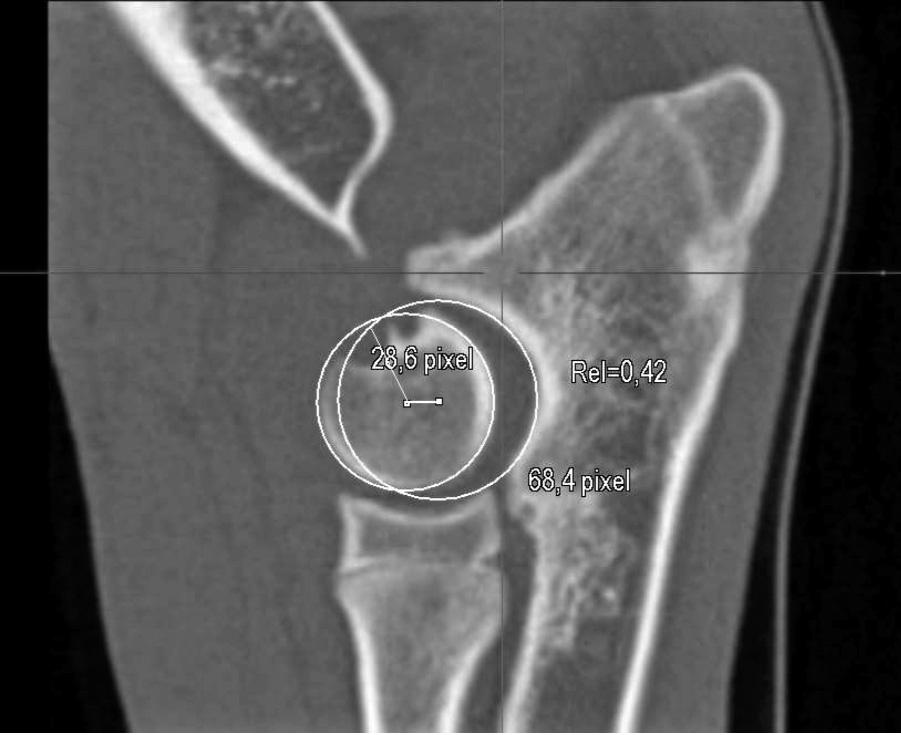 300/ Acta Chir Orthop Traumatol Cech. 84, 2017, No.