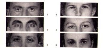 V konkavitě očnicové krajiny je oční štěrbina (rima palpebrarum), která má tvar vřetenovitý, polovřetenovitý, mandlovitý či polomandlovitý.