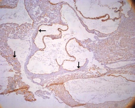 Obrázek 7: Příklad imunohistochemického barvení endoglinu v 16 týdenní normochol. skupině a 8 týdenní hyperchol. skupině v oblasti kořene aorty.