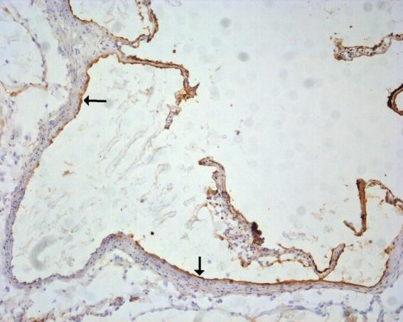 Obrázek 8: Příklad imunohistochemického barvení endoglinu v 16 týdenní normochol. skupině a 8 týdenní hyperchol. skupině v oblasti kořene aorty.