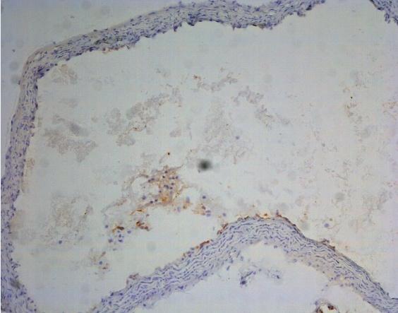 Obrázek 9: Příklad imunohistochemického barvení endoglinu v 16 týdenní normochol. skupině a 8 týdenní hyperchol. skupině v oblasti descendentní aorty.