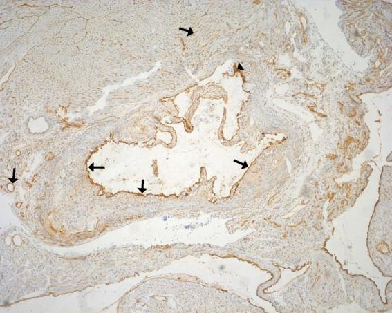 Obrázek 11: Příklad imunohistochemického barvení endoglinu v 16 týdenní hyperchol. skupině v oblasti aortálního sinu.
