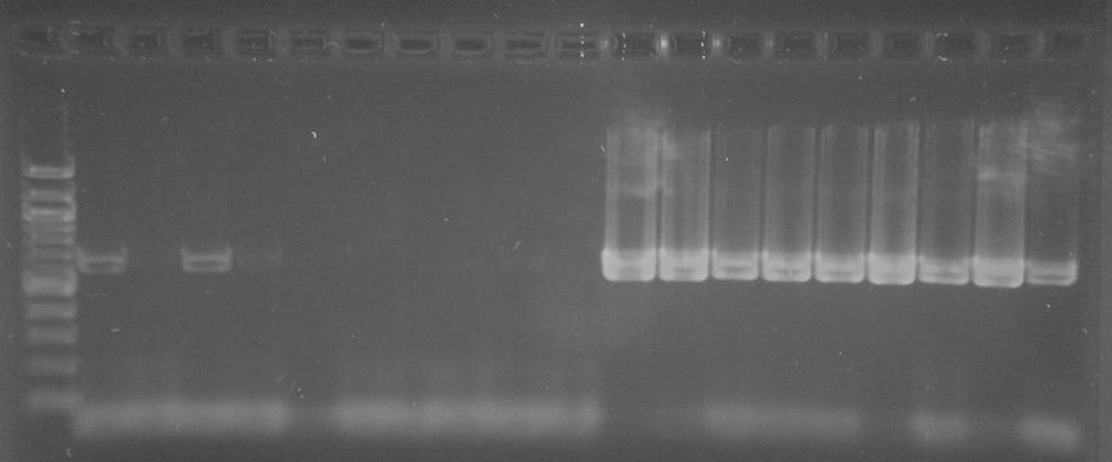 5.3 PCR s univerzálními primery pro doménu Bacteria Pro ověření amplifikovatelnosti izolované DNA zředěné na výslednou koncentraci 10 ng/µl byla provedena PCR s univerzálními primery pro doménu