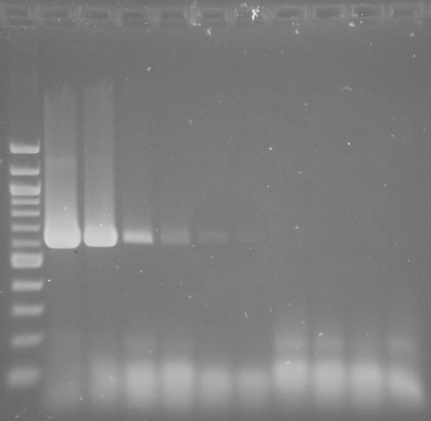 5.5 Stanovení citlivosti PCR s primery specifickými pro rod Použitím sady ředění DNA typového kmene butyricum DSM 10702 T do směsi pro PCR byla získána citlivost PCR se specifickými primery pro rod.