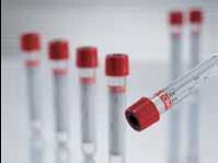 Zkumavka barva použití Vacuette 6 ml aktivátor červená sérum Vacuette 6 ml aktivátor + separační gel červená, žlutý střed sérum biochemie imunologie krevní skupina křížové testy biochemie imunologie