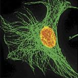 Zobrazování in vitro umožnuje sledovat dynamiku procesů v buňce QDs s protilátkou se dopravují do buňky endocytózou nebo pomocí modifikace peptidem - PTD