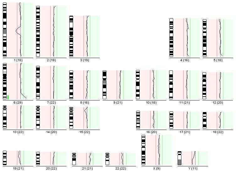 CGH: rev ish enh (6q25-qter) nebalancovaná chromosomová přestavba