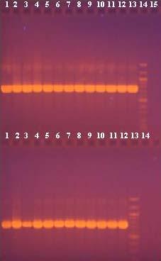 4.6.3 PCR reakce s purifikovanou DNA izolovanou z 25 lyofilizátů s použitím primerů specifických pro rod Enterococcus Vzorky purifikované DNA naředěné na koncentraci 10 ng/μl byly použity jako DNA