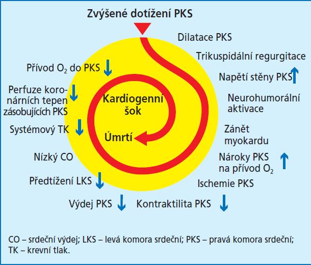 Plicní embolie