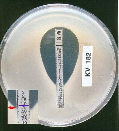 http://mikrobiologie.lf3.cuni.cz/bak/uceb/obsah/disktest/etest.htm METODY DETEKCE FENOTYPOVÉ (KULTIVAČNÍ) 2.