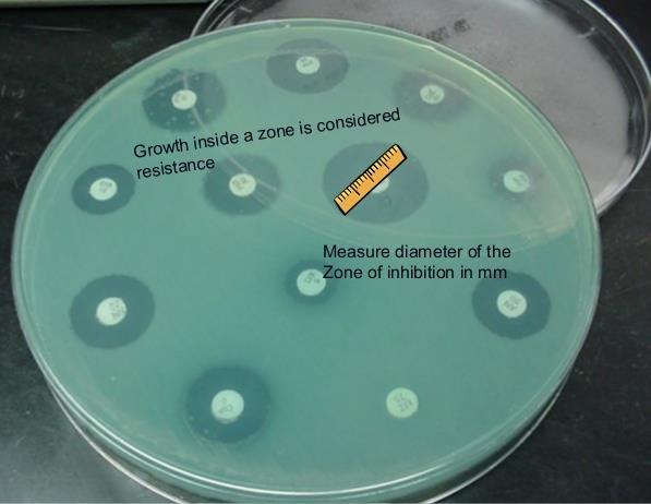 https://www.slideshare.net/microbeswithmorgan/susceptibility-testing-review METODY DETEKCE FENOTYPOVÉ (KULTIVAČNÍ) DIFÚZNÍ A DILUČNÍ TESTY 1.