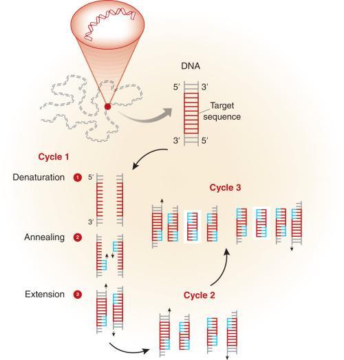 DNA. K odhalení LM se konkrétně značí úsek exonu 10 v genu pro faktor V. Metoda se skládá ze tří kroků, které se opakují cyklicky (viz obrázek 8).