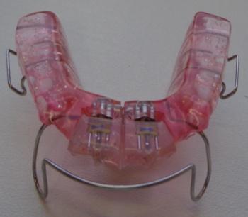 3 Šikmá ploška Jedná se o ortodontický aparát, který se nasazuje na zuby v dolní čelisti.