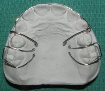 Vývoj a druhy snímatelných ortodontických aparátů. Absolventská práce - PDF  Free Download
