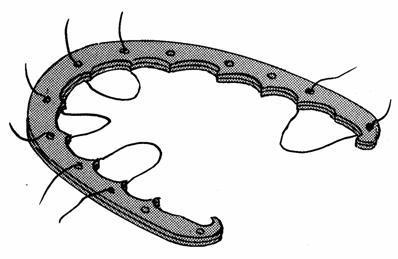1 Přehled vývoje snímatelných aparátů Ortodontické aparáty prošly dlouhým vývojem. Nejdříve to byly individuálně zhotovené originály.