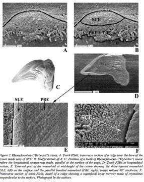 HybodonNa) zubysesekundárními výběžkyakomplexní sklovinou(enameloidem), narodílodrecentních ovšemzáklademvrstva isolovanýchkrystalitůq singlecrystallite enameloid Neoselachi produkt cenozoické