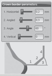 POUŽITÍ Okrajové parametry v CAD softwaru Ceramill Mind Dbejte na dostatečné tloušťky okrajů. Doporučené hodnoty jsou: _1. Tloušťka okraje (Horizontal): 0,2 mm _ 2. Šikmo (Angled): 0,3 mm _ 3.