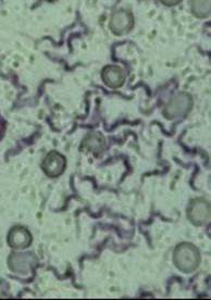 Jsou trypanosomy intracelulární nebo extracelulární parazité?