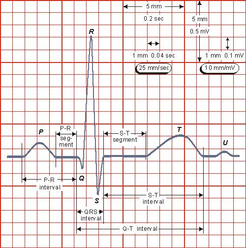 1.5. EKG signál EKG signál se skládá z několika důležitých vln a úseků (Obr. 1.5), jejichž charakteristika je popsána níže v textu.