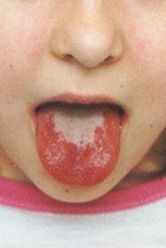 Dutina ústní rty - opary, ústní koutky, afty, známky dehydratace mandle - velikost,