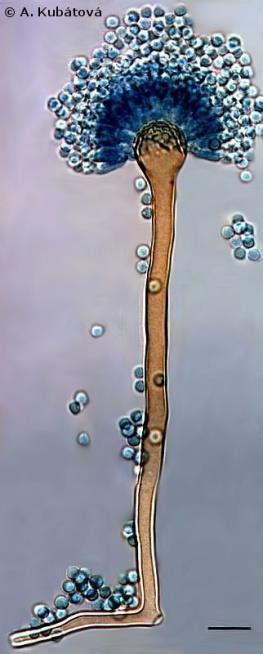 izolován i z klinického materiálu - Aspergillus niger produkce kyseliny citronové - Aspergillus