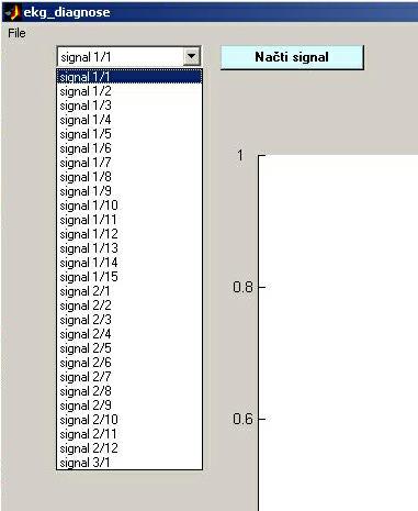 programu EKG