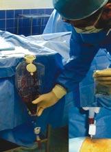 Infarkt myokardu, remodelace levé komory a buněčná terapi e angi ogeneze BMSCs, EPCs myogeneze (kontraktilní buňky) mesenchymální buňky skeletální myoblasty akutní infarkt myokardu zánětlivá