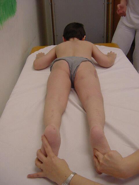 Období předoperační Obrázek Vzájemný kontakt dítě fyzioterapeut