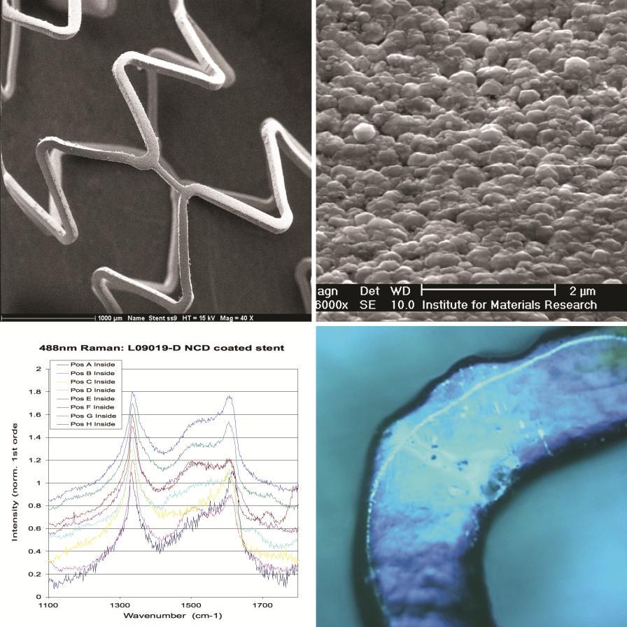 Obrázek 5. NCD potažený stent zobrazený elektronovou mikroskopií ve zvětšení 40x (vlevo nahoře) a ve zvětšení 16000x (vpravo nahoře).