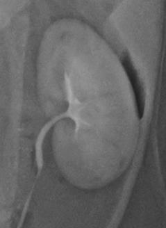 Uretrografie Vaginouretrografie