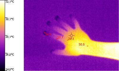 Termogram