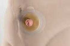 Pomůcky Coloplast Brava elastické vyrovnávací pásky pro vyšší pocit bezpečí Extra ochrana různé potřeby.