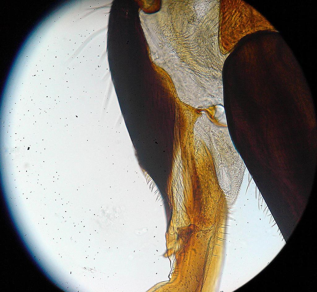 Klouby čelisti ( maxilla ) podbradek ( submentum ) brada ( mentum ) násadec