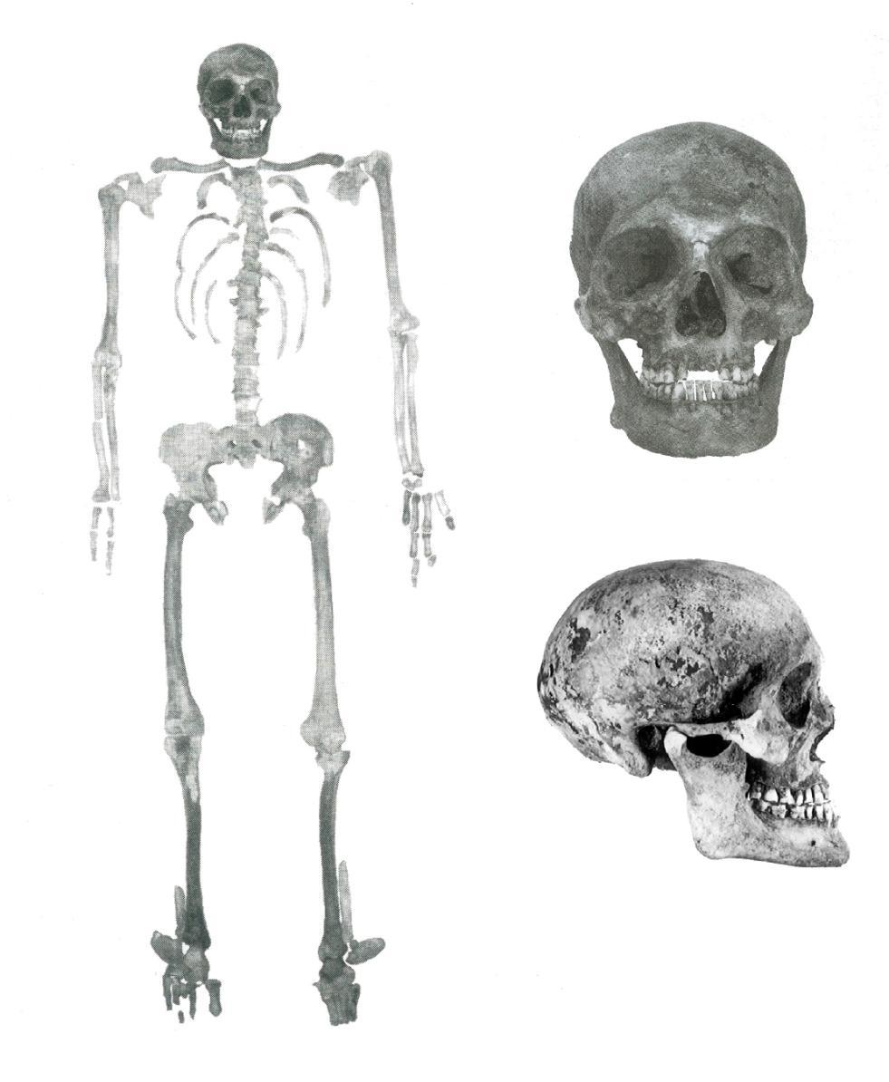 4.2.1.1 Lebka Lebka markraběte Jošta byla oproti ostatním kostem velmi dobře zachovalá, chyběli pouze 2 zuby, které vypadly, když lebka spadla z hedvábného polštářku, na němž spočívala.