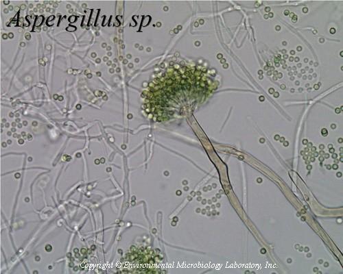 Aspergillus sp.