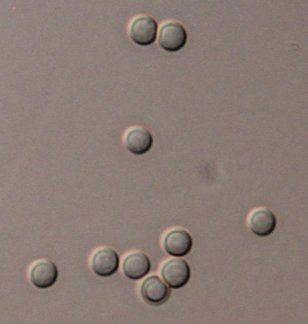 Obrázek č. 13: Penicillium verrucosum - konidie Obrázek č.