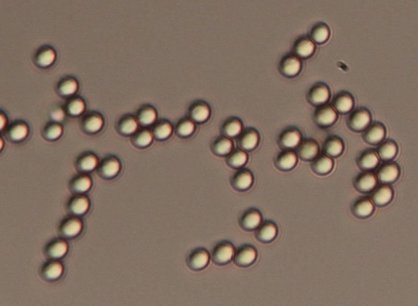 Morfologie a fyziologie Penicillium citrinum Thom Kolonie na CYA při teplotě 25 C jsou po 7 dnech 2,7-3,3 cm velké, na okraji bílé, uprostřed modro šedivo zelené,