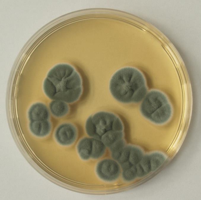 Obrázek č. 20: Penicillium citrinum - líc kolonie na sladinovém agaru pro Penicillium Obrázek č. 21: Penicillium citrinum - líc kolonie na CYA 2.3. Detekce toxikogenních hub molekulárními metodami 2.